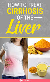 How to eat with cirrhosis of the liver | ohio state medical center. 16 Cirrhosis Of The Liver Friendly Foods Ideas In 2021 Liver Diet Healthy Liver Fatty Liver Diet
