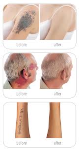 The motherland of cover up is considered to be japan. Camouflage Concealer Makeup For Tattoo Scar Birthmark Cover By Rio
