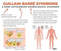 Guillain Barre Syndrome Singapore Posts Facebook
