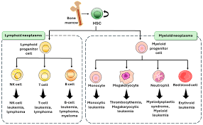 Image result for Hematologic Cancer