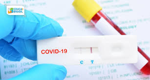 É indicado para quem teve exposição recente ao vírus. Testes De Covid 19 Poderao Ser Realizados Em Farmacias Educa Mais Brasil