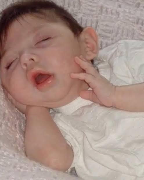 Inspiring Story of Alex Simpson: A Real-Life Miracle | TikTok