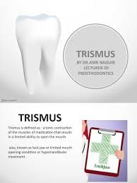 Image result for Trismus