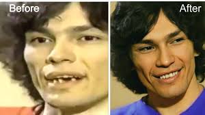 Hartista con h de hartar , que sí usa cubrebocas. Richard Ramirez Teeth Fix Before And After Night Stalker Wife Death