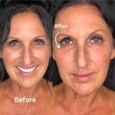 Farah Awadalla, MD aka Dr. Bobby(@drskincredible) • Instagram 사진 및 동영상