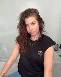 Beaute Ces Stars Qui Nous Aident A Decomplexer Face A Nos Problemes De Peau En 2020 Probleme De Peau Beaute Bouton Acne