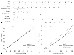 A Nomogram For Predicting Ipc In Localized Prostate Cancer