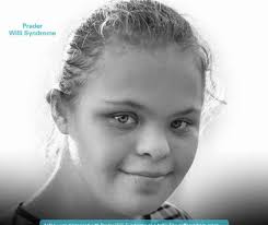 بە ساوایی کاتێک کە بوو زۆر ورد و بچووک بوو، بە سرنج شیرمان پێ ئەیا! دوای  ساڵ وردە وردە بەرەو قەڵەوی ڕۆشت و ئێستا کێشی زیاترە لە ھەر مناڵێکی  ھاوتەمەنی خۆی! بەڵام