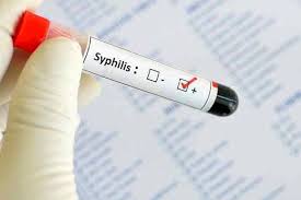 Pada 2017, sekitar 7.000 orang di inggris dan 33.189 orang di eropa didiagnosis menderita sifilis. Harus Diwaspadai Penyakit Jadul Kembali Meningkat Balipost Com