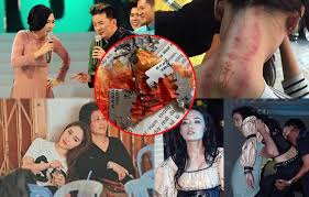 Maybe you would like to learn more about one of these? Nhá»¯ng Láº§n ChÆ¡i Ngáº£i Bi Hiá»ƒm Khiáº¿n Sao Viá»‡t Khá»• Táº­n Cam Lai