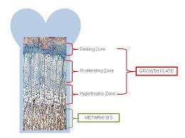Image result for Growth Plate