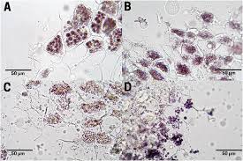 Image result for Metteniusaceae