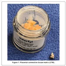 C) glandular connective tissue, exocrine connective tissue, and endocrine connective tissue. The Use Of An Acellular Connective Tissue Matrix In Hindfoot And Ankle Fusions Understanding The Cellular Bench Top Data With A Consecutive Patient Series A Pilot Study