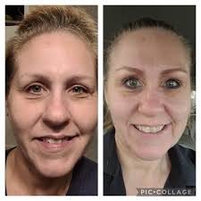 Laging pagod at puyat sa work? walang maayos na tulog ? Try mona itong  Yumirae collagen plus ❤ COLLAGEN PLUS BENEFITS : ✨✨✨✨✨ ✓Anti Stress ✓Good  sleeping ✓Boost body system ✓Strengthens teeth