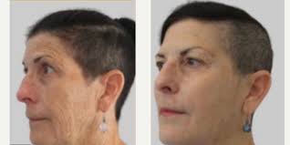 Leslie Pickens, MD, Board Certified Emergency Medicine Physician