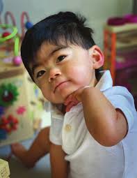 COVID-19 Vaccine and Individuals with CdLS Palliative Care Benefits