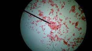 How to see animal cell in microscope. Animal Cells Under A Microscope Youtube
