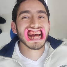 Cirujano Dentista Samara Estrada