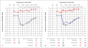 audiometry screening and interpretation american family