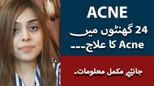 See here to get trance / hypnose.mp3 gegen pruefungsangst beim fuehrerschein today! Acne Ka Ilaj In Urdu Hindi How To Remove Pimples Overnight Acne Treatment Dr Amna Rasul Youtube