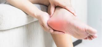 Tumit merupakan bagian dari organ telapak kaki yang paling sering mengalami rasa nyeri dan sakit yang berlangsung secara bertahap, biasanya rasa sakit akan semakin parah seiring berjalannya waktu. Sakit Tumit Kaki Ketahui 13 Punca Sakit Tumit Yang Patut Anda Tahu
