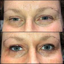 I Cyndy, have an open spot tomorrow @ 10am call the studio for appointment  3072340111