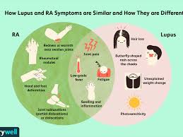 Differences Between Rheumatoid Arthritis And Lupus