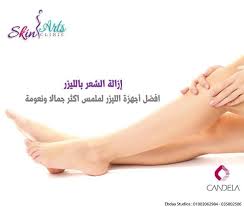 جهاز كانديلا ليزر لإزالة الشعر سكين أرتس أفضل مركز تجميل لإزالة الشعر بالليزر بالإسكندرية Skin Clinic Skin Art