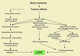 Traditionally, emphasis was given to the most severe acute reduction in kidney function, as manifested by severe azotaemia and often by oliguria or anuria. Jci Acute Renal Failure Definitions Diagnosis Pathogenesis And Therapy