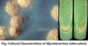 2% ogawa medium for the diagnosis of tuberculosis. Lowenstein Jensen Lj Media Culture Media Microbe Notes
