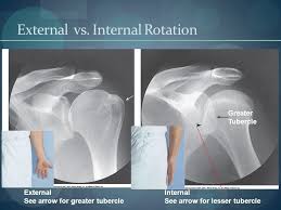 Pin By Lama A On X Ray Radiology Student Radiology Radiology Technologist