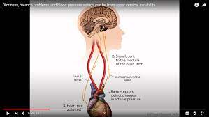 Can Cervical Spine Instability Cause Heart Palpitations And Blood Pressure Problems Caring Medical Florida