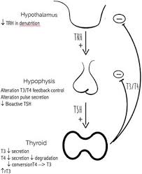 Frontiers Hypothyroidism As A Predictor Of Surgical