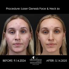 About Face Skin Care Med Spa