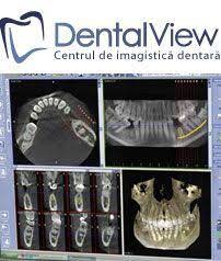 „radiografiile dentare joacă un rol foarte important în diagnosticul afecțiunilor dentare. Yts Dental View Laborator Radiologie Dentara Sector 1 Bucuresti