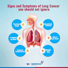Cancer cachexia, a syndrome including unintentional weight loss and muscle wasting, is very common in the later stages of cancer. Facebook