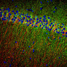 Mark Dell'Acqua, PhD