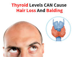 It works by reducing the amount of sugar your liver releases. Can Metformin Cause Thyroid