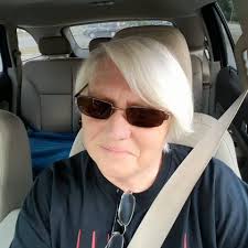 Red palms and downward nail growth with RA?