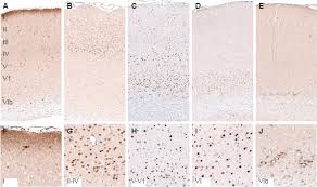 Cas ads article google scholar Cortical Layer Markers From Atlas Antibodies