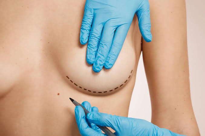 Breast Augmentation Dubai | Enlargement Surgery Options