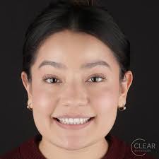 Clear Dental Studio (@cleardentalstudio) · Broomfield, CO