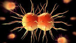  UK Man Suffering 'Worst-Ever' Case of Super-Gonorrhoea