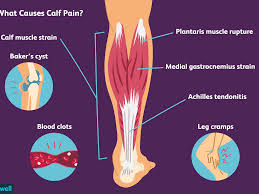 If i do the left leg it does hurt the right problem area. Calf Pain Causes Treatment And When To See A Doctor