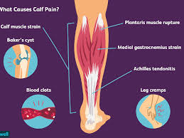Muscles of the anterior hip and thigh. Calf Pain Causes Treatment And When To See A Doctor