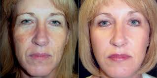 Jeffrey Marvel, MD Reviews, Before and After Photos, Answers