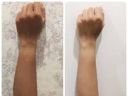 We did not find results for: Mengenal Infus Kecanntikan Yang Lagi Tren Bikin Kulit Putih Secara Instant