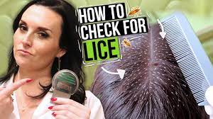 A clinician checked the person's head two days later, then again one and two weeks later. How To Check For Lice 5 Lice Treatment Tips From A Professional Youtube