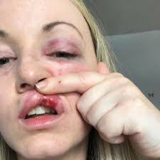 Ana Moye's Instagram, Twitter & Facebook