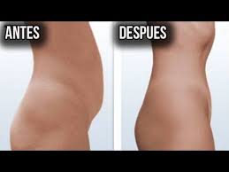 Como Eliminar La Celulitis De Las Piernas Y Gluteos Rapidamente En Casa Pin En Ejercicios